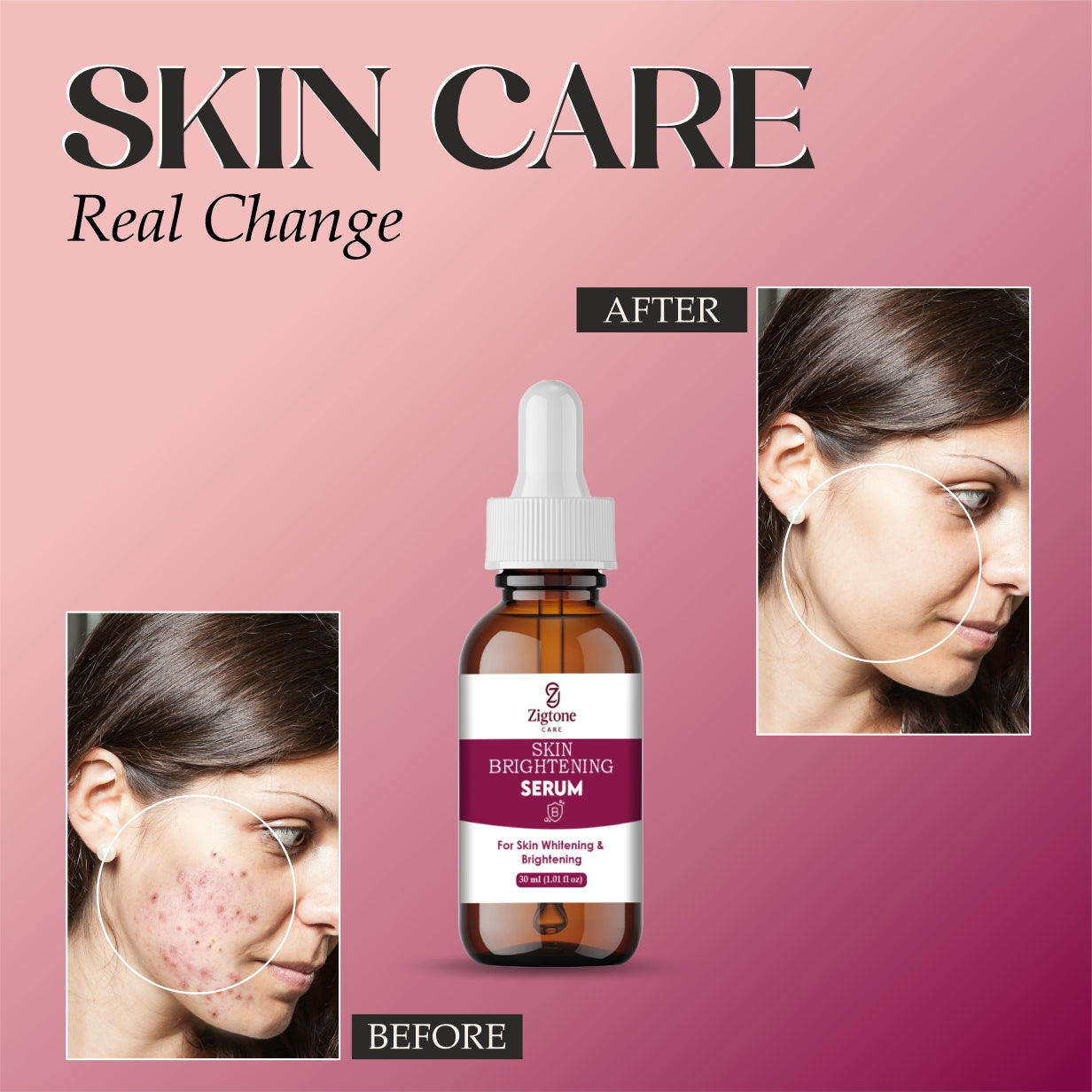 Zigtone Skin Brightening Serum, Premium Whitening Formula, Amber Glass Bottle with Dropper, 30ml
