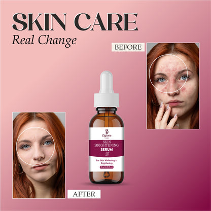 Zigtone Skin Brightening Serum, Premium Whitening Formula, Amber Glass Bottle with Dropper, 30ml